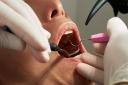 Dentist stock image