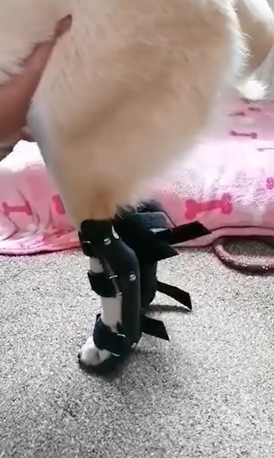 SUPPORT: Bella showing off her leg braces