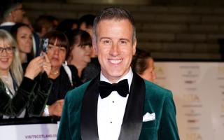 Have you seen Anton Du Beke's new look? This is why he has had a hair transformation